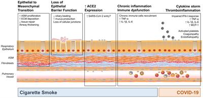 Cigarette Smoke Exposure, Pediatric Lung Disease, and COVID-19